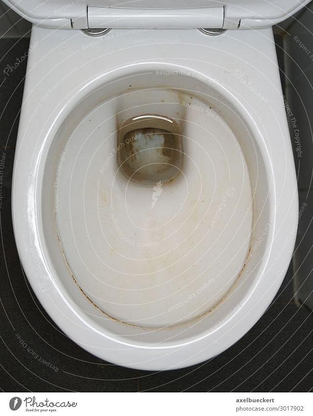 I et svært alvorlig tilfelle av en gammel urinstein på toalettet